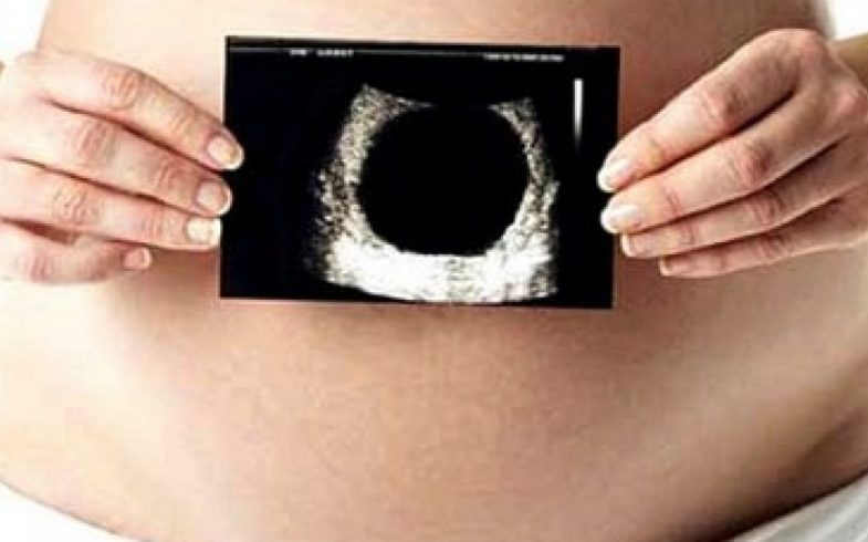 BRIGHTEN OVUM (ANEMBRYONIC PREGNANCY)